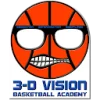 3D vision
